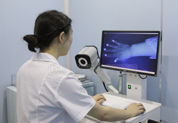西南首台白癜风智能(AI)成像检测系统