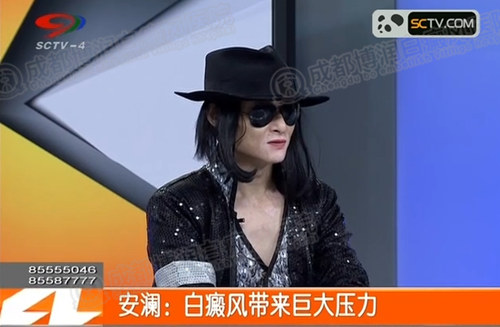 白癜风患者面临的巨大压力