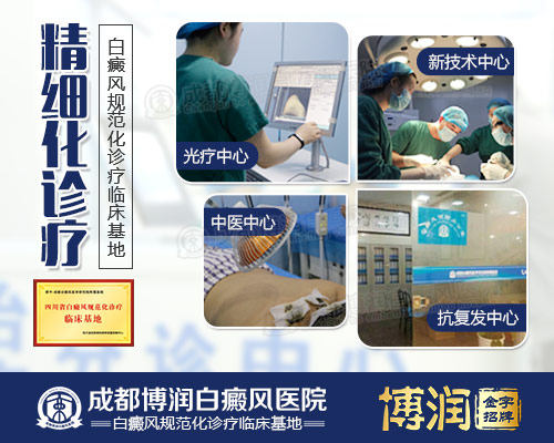 白癜风精细化诊疗