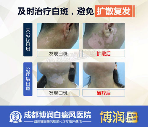 深秋控制白斑,避免来年扩散