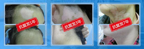 抗复发中心诊疗档案